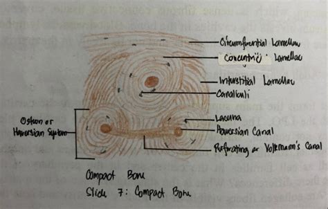 [Solved] please draw it and label C. Other CT 1. 6R. Bone 3.. Spend some... | Course Hero