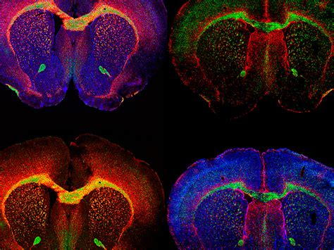 Neuroscience Initiative – The Advanced Science Research Center