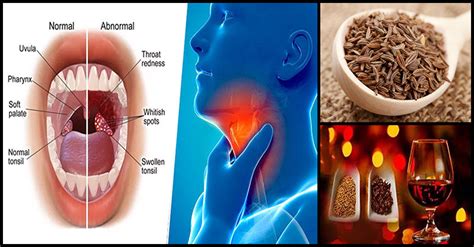 A Simple Home Remedy For Sore Throat And Tonsillitis - Dr. Farrah MD