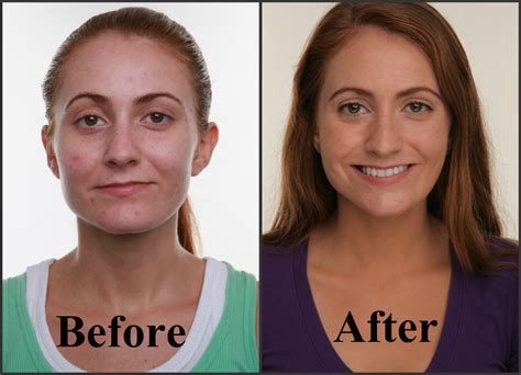 Neutrogena skiniD Before & After Photo | The before and afte… | Flickr