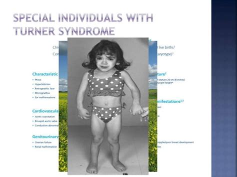 Chromosomal anomalies | PPT