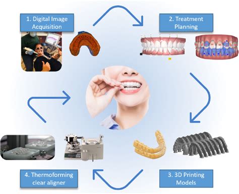 Workflow of fabrication of clear aligners by the thermoforming process ...