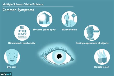 Vision Problems Caused By MS