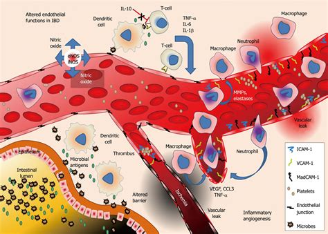 Eclampsia as related to Inflammation - Pictures