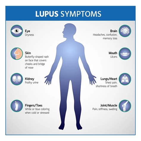 Understanding the Causes, Diagnosis and Treatment of Lupus