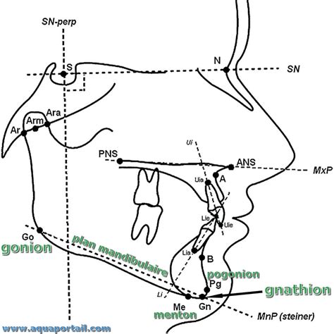 Gnathion, pogonion, gonion : définitions