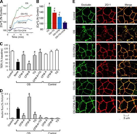 Extracellular calcium influx and intracellular store-operated calcium... | Download Scientific ...