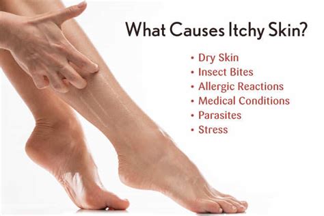 home remedies for itchy skin | Femina.in