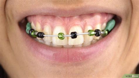 How to Make Fake Braces: 11 Steps (with Pictures)