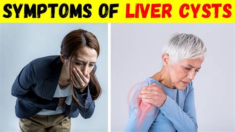 Symptoms of Liver Cysts and Pain Causes and Treatment - YouTube