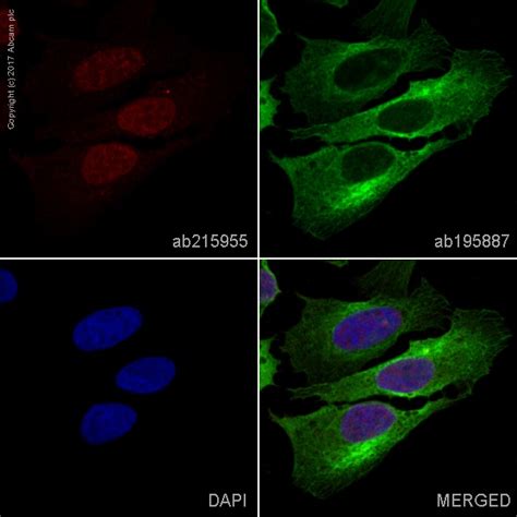 Alexa Fluor® 647 Anti-RUNX2 antibody [EPR14334] (ab215955) | Abcam