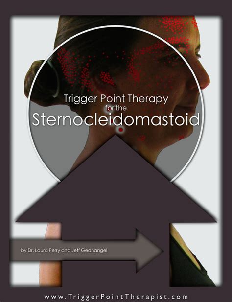 Trigger Point Video for Sternocleidomastoid Muscle ...