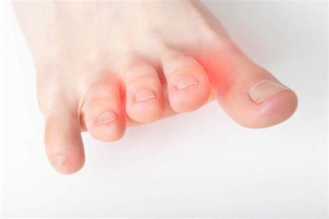 4 Tips to Manage Toe Arthritis: Cortez Foot & Ankle Specialists: Podiatry