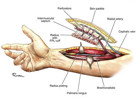 From Sketchbook to Scalpel: The Medical Illustrations of Dr. Ruston Sanchez - Department of Surgery