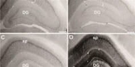 Restoring Aging Genes in Rats | Lab Manager