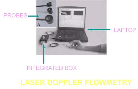 Endodontics: LASER DOPPLER FLOWMETRY