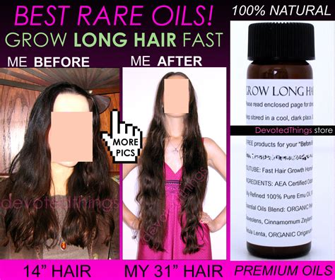 BEST SUPER FAST HAIR GROWTH SYSTEM Natural Hair Growth Products KIT- 3 piece - Sets & Kits