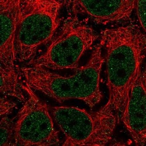 Anti-Laminin alpha 5/LAMA5 antibody (ab220399) | Abcam