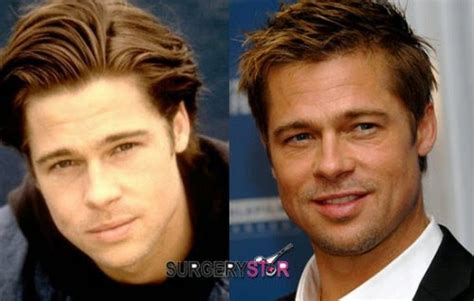 Brad Pitt Botox and Facial Fillers Plastic Surgery Before and After