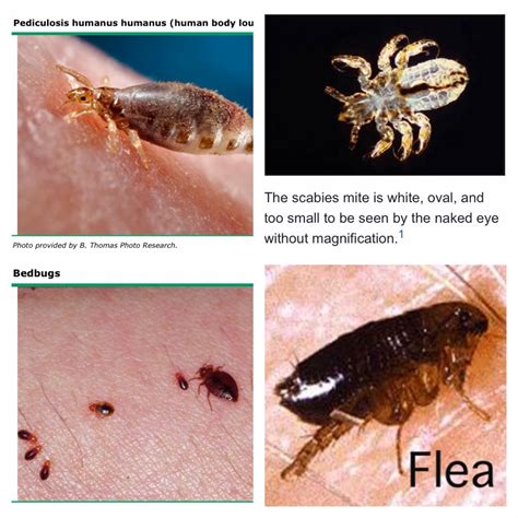 Bed Bugs Vs Scabies The Difference Between Them Termi - vrogue.co