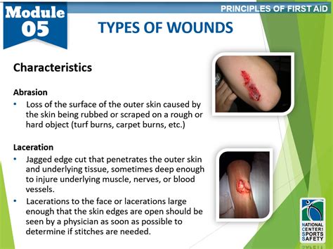 Wound Types Classifications