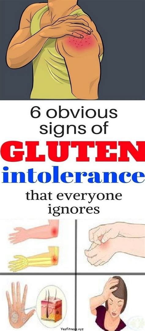 8 Obvious Signs of Gluten Intolerance That Everyone Ignores | Signs of ...