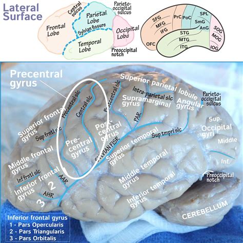 Neuroanatomy Glossary: Precentral gyrus | Draw It to Know It