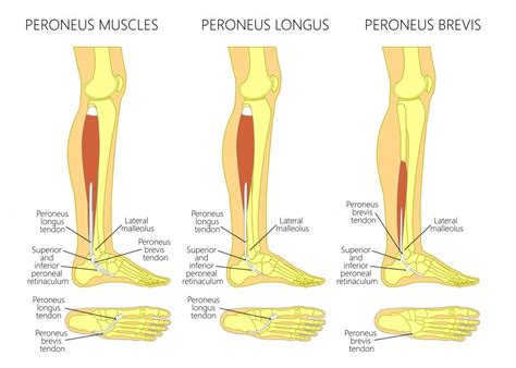 Common Lower Leg and Calf Injuries - My Family Physio