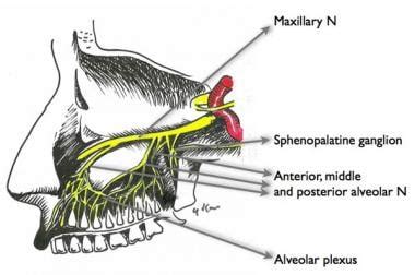 Maxillary Nerve Block High Tuberosity Approach