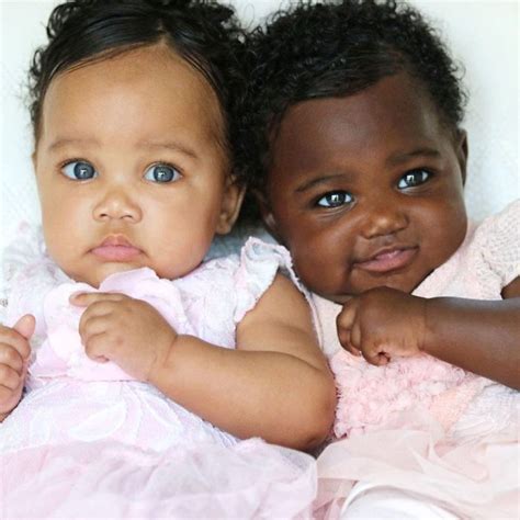 Twins Born With Different Color Skintones Win Over Our Hearts, Proving ...