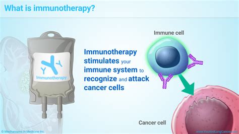 Slide Show - Understanding Immunotherapy for Lung Cancer