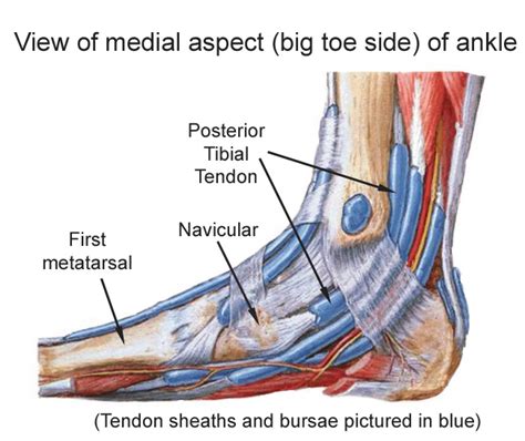 Posterior Tibial Tendonitis - Drwolgin