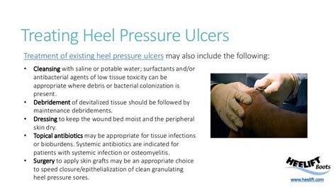 Heel Pressure Ulcer Prevention