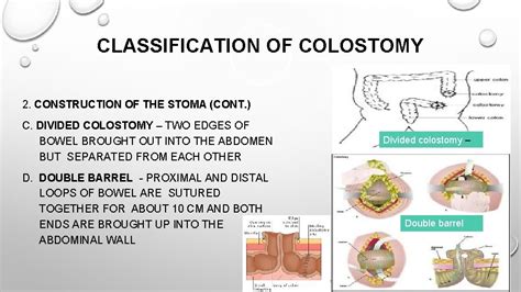 Outline ENDOSCOPY INDICATIONS CONTRAINDICATIONS COMPLICATIONS NURSING RESPONSIBILITIES COLOSTOMY