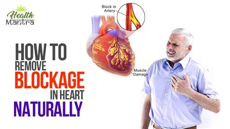 How to Remove blockage in heart naturally! - YouTube