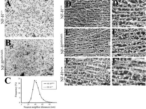 Structure of axoplasm in the presence or absence of NF-H or its tail ...