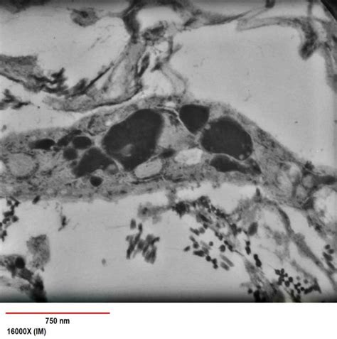 Electron micrograph, Muller cells in the retina in postnatal day 28 ...