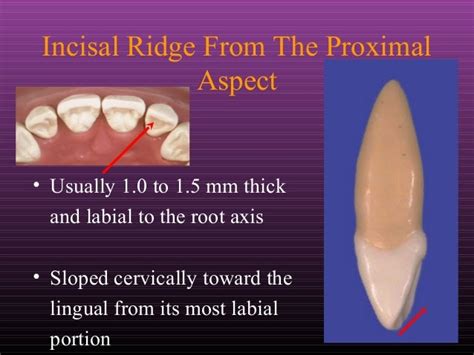 Maxillary Lateral and Mandibular Incisors