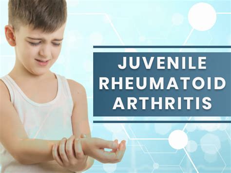 Juvenile Rheumatoid (Idiopathic) Arthritis: Causes, Symptoms, Diagnosis And Treatment - Boldsky.com