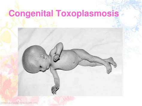 PPT - Toxoplasmosis PowerPoint Presentation, free download - ID:4797160