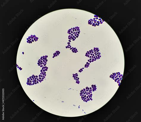 Culture colonies gram stained Microscopic 100x show Candida spp, fungi ...