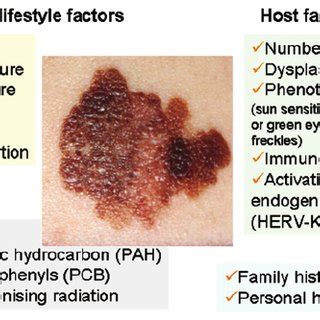 Risk factors for cutaneous melanoma. | Download Scientific Diagram