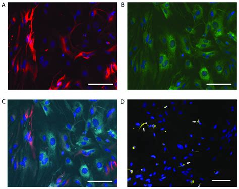 Primary cell cultures are enriched with astrocytes. Representative... | Download Scientific Diagram