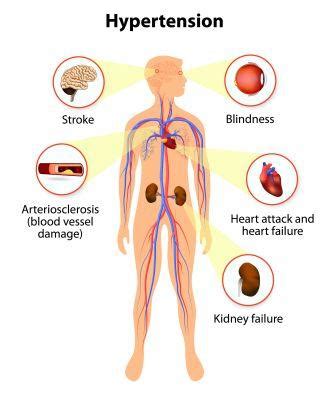 Hypertension: Types, Ayurvedic Treatment, Health Tips