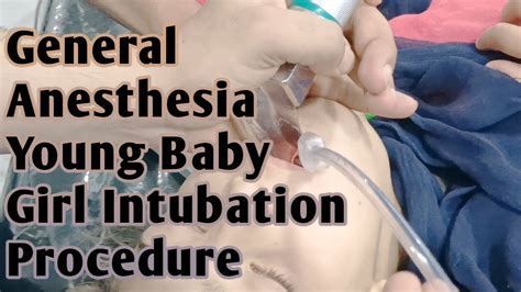 General Anesthesia Intubation Procedure | Young Baby Girl Anesthesia Intubation | Anesthetic ...