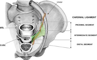 Cardinal ligament surgical anatomy: cardinal points at hysterectomy | SpringerLink