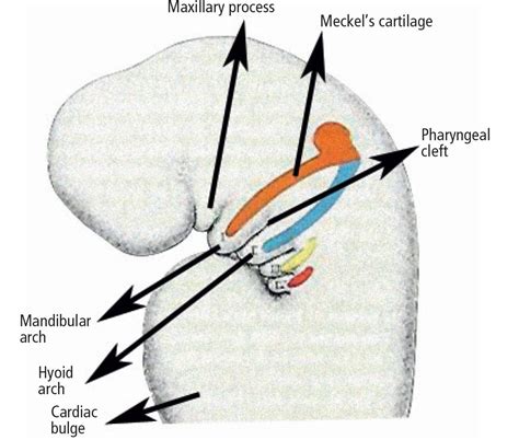 CLINICAL FEATURES OF FIRST AND SECOND BRANCHIAL ARCH SYNDROMES | Pocket ...