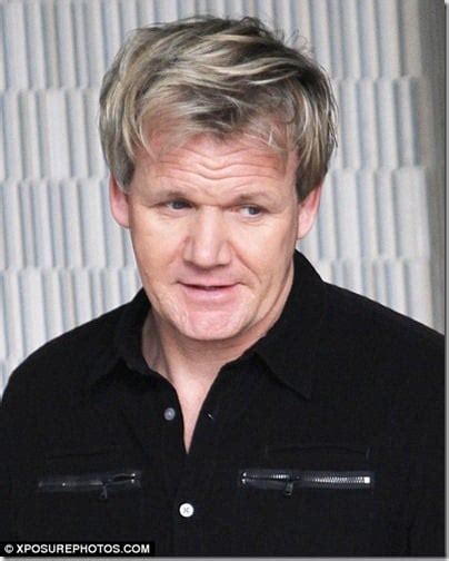 Gordon Ramsay’s Hair Transplant – Worth The Money, Or £30,000 Flushed ...