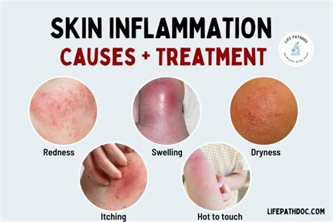 Skin Inflammation: Pictures, Types, Causes and Treatment