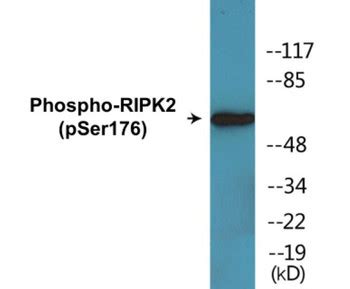 Mouse IL-8 ELISA Kit (MOFI01258)- High Sensitivity